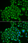 Recoverin Antibody - Immunofluorescence analysis of MCF-7 cells.