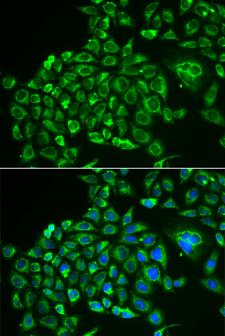 Recoverin Antibody - Immunofluorescence analysis of MCF-7 cells.