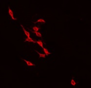 Recoverin Antibody - Staining NIH-3T3 cells by IF/ICC. The samples were fixed with PFA and permeabilized in 0.1% Triton X-100, then blocked in 10% serum for 45 min at 25°C. The primary antibody was diluted at 1:200 and incubated with the sample for 1 hour at 37°C. An Alexa Fluor 594 conjugated goat anti-rabbit IgG (H+L) Ab, diluted at 1/600, was used as the secondary antibody.