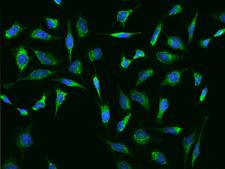 Recoverin Antibody - Immunofluorescence staining of RCVRN in HeLa cells. Cells were fixed with 4% PFA, permeabilzed with 0.3% Triton X-100 in PBS, blocked with 10% serum, and incubated with rabbit anti-Human RCVRN polyclonal antibody (dilution ratio 1:200) at 4°C overnight. Then cells were stained with the Alexa Fluor 488-conjugated Goat Anti-rabbit IgG secondary antibody (green) and counterstained with DAPI (blue). Positive staining was localized to Cytoplasm.