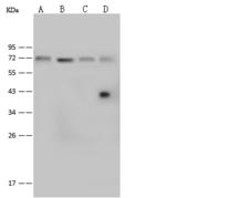 RECQ1 / RECQL Antibody - Anti-RECQL rabbit polyclonal antibody at 1:500 dilution. Lane A: NIH 3T3 Whole Cell Lysate. Lane B: HeLa Whole Cell Lysate. Lane C: Raji Whole Cell Lysate. Lane D: U-937 Whole Cell Lysate. Lysates/proteins at 30 ug per lane. Secondary: Goat Anti-Rabbit IgG (H+L)/HRP at 1/10000 dilution. Developed using the ECL technique. Performed under reducing conditions. Predicted band size: 72 kDa. Observed band size: 72 kDa.
