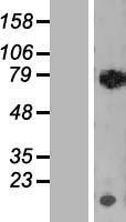 RECQ1 / RECQL Protein - Western validation with an anti-DDK antibody * L: Control HEK293 lysate R: Over-expression lysate