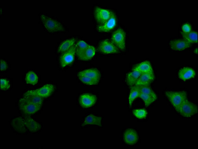 RECQL4 Antibody - Immunofluorescence staining of HepG2 cells diluted at 1:166, counter-stained with DAPI. The cells were fixed in 4% formaldehyde, permeabilized using 0.2% Triton X-100 and blocked in 10% normal Goat Serum. The cells were then incubated with the antibody overnight at 4°C.The Secondary antibody was Alexa Fluor 488-congugated AffiniPure Goat Anti-Rabbit IgG (H+L).