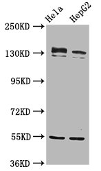 RECQL4 Antibody - Western Blot Positive WB detected in: Hela whole cell lysate, HepG2 whole cell lysate All Lanes: RECQL4 antibody at 4.8µg/ml Secondary Goat polyclonal to rabbit IgG at 1/50000 dilution Predicted band size: 134 KDa Observed band size: 134 KDa