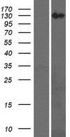 RECQL4 Protein - Western validation with an anti-DDK antibody * L: Control HEK293 lysate R: Over-expression lysate