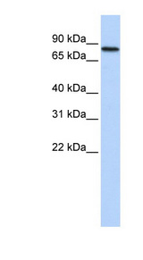 RED2 / ADARB2 Antibody - ADARB2 / RED2 antibody Western blot of Fetal Heart lysate. This image was taken for the unconjugated form of this product. Other forms have not been tested.