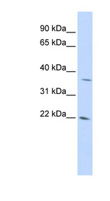 REDD-2 / DDIT4L Antibody - DDIT4L antibody Western blot of 293T cell lysate. This image was taken for the unconjugated form of this product. Other forms have not been tested.