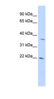 REDD-2 / DDIT4L Antibody - DDIT4L antibody Western blot of 293T cell lysate. This image was taken for the unconjugated form of this product. Other forms have not been tested.