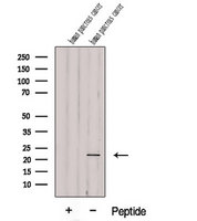 REDD-2 / DDIT4L Antibody - Western blot analysis of extracts of human pancreas carcinoma tissue using DDIT4L antibody. The lane on the left was treated with blocking peptide.