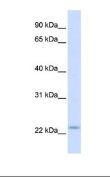 REEP1 Antibody - Fetal muscle lysate. Antibody concentration: 1.0 ug/ml. Gel concentration: 12%.  This image was taken for the unconjugated form of this product. Other forms have not been tested.