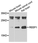 REEP1 Antibody - Western blot analysis of extracts of various tissues.