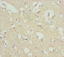 REEP1 Antibody - Immunohistochemistry of paraffin-embedded human brain tissue at dilution 1:100