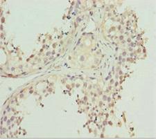 REEP1 Antibody - Immunohistochemistry of paraffin-embedded human testis tissue at dilution 1:100