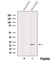 REEP1 Antibody - Western blot analysis of extracts of mouse brain tissue using REEP1 antibody. The lane on the left was treated with blocking peptide.