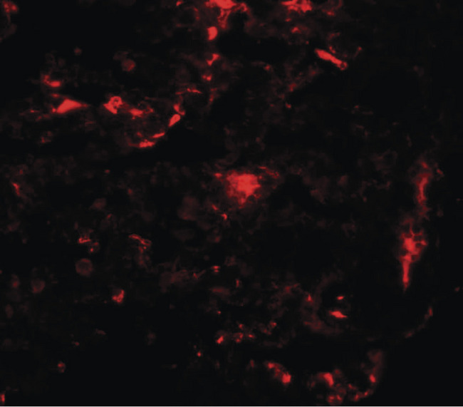 REEP2 Antibody - Immunofluorescence of REEP2 in rat lung tissue with REEP2 antibody at 20 ug/ml.