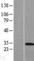 REEP3 Protein - Western validation with an anti-DDK antibody * L: Control HEK293 lysate R: Over-expression lysate