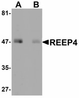 REEP4 Antibody - Western blot of REEP4 in human lung tissue lysate with REEP4 antibody at 1 ug/ml in (A) the absence and (B) the presence of blocking peptide.