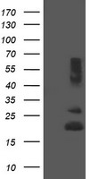 REEP5 Antibody - HEK293T cells were transfected with the pCMV6-ENTRY control (Left lane) or pCMV6-ENTRY REEP5 (Right lane) cDNA for 48 hrs and lysed. Equivalent amounts of cell lysates (5 ug per lane) were separated by SDS-PAGE and immunoblotted with anti-REEP5.