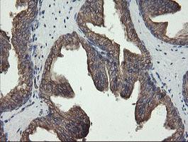 REEP5 Antibody - IHC of paraffin-embedded Human prostate tissue using anti-REEP5 mouse monoclonal antibody.