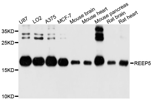 REEP5 Antibody - Western blot analysis of extracts of various cell lines, using REEP5 antibody at 1:1000 dilution. The secondary antibody used was an HRP Goat Anti-Rabbit IgG (H+L) at 1:10000 dilution. Lysates were loaded 25ug per lane and 3% nonfat dry milk in TBST was used for blocking. An ECL Kit was used for detection and the exposure time was 1s.