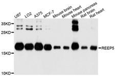 REEP5 Antibody - Western blot analysis of extracts of various cell lines, using REEP5 antibody at 1:1000 dilution. The secondary antibody used was an HRP Goat Anti-Rabbit IgG (H+L) at 1:10000 dilution. Lysates were loaded 25ug per lane and 3% nonfat dry milk in TBST was used for blocking. An ECL Kit was used for detection and the exposure time was 1s.
