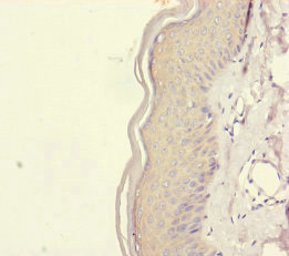 REEP5 Antibody - Immunohistochemistry of paraffin-embedded human skin tissue at dilution of 1:100