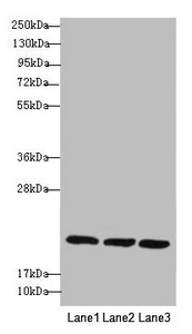 REEP5 Antibody - Western blot All Lanes: REEP5 antibody at 1.02 ug/ml Lane 1: MCF7 whole cell lysate Lane 2: K562 whole cell lysate Lane 3: Hela whole cell lysate Secondary Goat polyclonal to rabbit IgG at 1/10000 dilution Predicted band size: 22,15 kDa Observed band size: 21 kDa