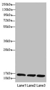 REEP5 Antibody - Western blot All lanes: REEP5 antibody at 1.02µg/ml Lane 1: MCF-7 whole cell lysate Lane 2: K562 whole cell lysate Lane 3: Hela whole cell lysate Secondary Goat polyclonal to rabbit IgG at 1/10000 dilution Predicted band size: 22, 15 kDa Observed band size: 15 kDa