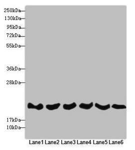 REEP5 Antibody - Western blot All Lanes: REEP5 antibody at 4.56 ug/ml Lane 1: Mouse kidney tissue Lane 2: Mouse lung tissue Lane 3: Jurkat whole cell lysate Lane 4: MCF7 whole cell lysate Lane 5: K562 whole cell lysate Lane 6: Hela whole cell lysate Secondary Goat polyclonal to rabbit IgG at 1/10000 dilution Predicted band size: 22,15 kDa Observed band size: 21 kDa