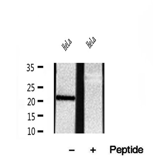 REEP5 Antibody - Western blot analysis of extracts of HeLa cells using REEP5 antibody.