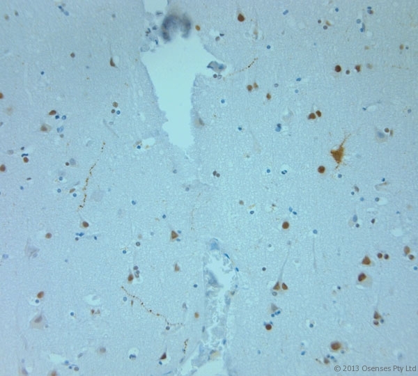REEP6 Antibody - Rabbit antibody to REEP6 (2-50). IHC-P on paraffin sections of human brain. HIER: Tris-EDTA, pH 9 for 20 min using Thermo PT Module. Blocking: 0.2% LFDM in TBST filtered through a 0.2 micron filter. Detection was done using Novolink HRP polymer from Leica following manufacturers instructions. Primary antibody: dilution 1:1000, incubated 30 min at RT (using Autostainer). Sections were counterstained with Harris Hematoxylin.