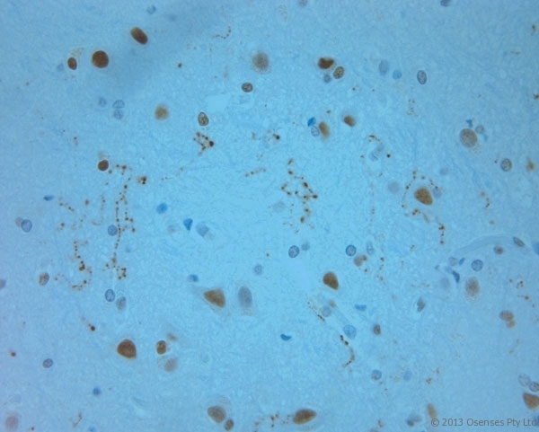 REEP6 Antibody - Rabbit antibody to REEP6 (2-50). IHC-P on paraffin sections of human brain. HIER: Tris-EDTA, pH 9 for 20 min using Thermo PT Module. Blocking: 0.2% LFDM in TBST filtered through a 0.2 micron filter. Detection was done using Novolink HRP polymer from Leica following manufacturers instructions. Primary antibody: dilution 1:1000, incubated 30 min at RT (using Autostainer). Sections were counterstained with Harris Hematoxylin.