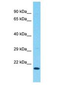REEP6 Antibody - REEP6 antibody Western Blot of THP-1. Antibody dilution: 1 ug/ml.  This image was taken for the unconjugated form of this product. Other forms have not been tested.