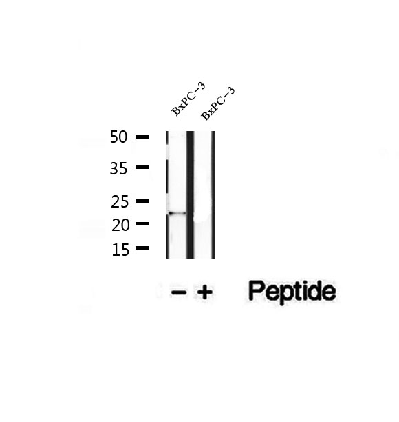 REEP6 Antibody - Western blot analysis of extracts of BxPC-3 cells using REEP6 antibody.