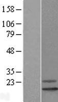 REEP6 Protein - Western validation with an anti-DDK antibody * L: Control HEK293 lysate R: Over-expression lysate