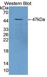 REG1A Antibody - Western blot of REG1A antibody.