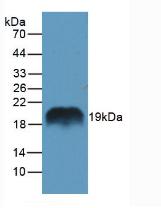 REG1A Antibody - Western Blot; Sample: Rat Pancreas Tissue.