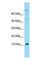REG1A Antibody - REG1A / REG antibody Western Blot of Fetal Liver. Antibody dilution: 1 ug/ml.  This image was taken for the unconjugated form of this product. Other forms have not been tested.