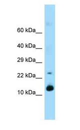 REG1A Antibody - REG1A / REG antibody Western Blot of Mouse Pancreas.  This image was taken for the unconjugated form of this product. Other forms have not been tested.