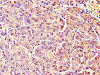 REG1A Antibody - Immunohistochemistry of paraffin-embedded human pancreatic tissue using REG1A Antibody at dilution of 1:100