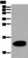 REG1A Antibody - Western blot analysis of Human pancreas tissue lysate  using REG1A Polyclonal Antibody at dilution of 1:500