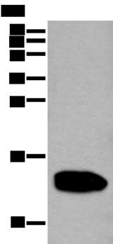 REG1A Antibody - Western blot analysis of Human pancreas tissue lysate  using REG1A Polyclonal Antibody at dilution of 1:350