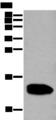 REG1A Antibody - Western blot analysis of Human pancreas tissue lysate  using REG1A Polyclonal Antibody at dilution of 1:350