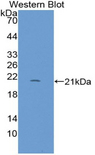 REG1B Antibody - Western blot of recombinant REG1B.