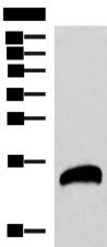 REG1B Antibody - Western blot analysis of Human pancreas tissues lysate  using REG1B Polyclonal Antibody at dilution of 1:800