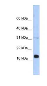 REG1B Antibody - REG1B antibody Western blot of Transfected 293T cell lysate. This image was taken for the unconjugated form of this product. Other forms have not been tested.