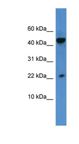 REG3A Antibody - REG3A antibody Western blot of HeLa lysate. This image was taken for the unconjugated form of this product. Other forms have not been tested.