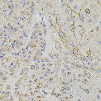 REG3A Antibody - Immunohistochemistry of paraffin-embedded mouse brain using REG3A antibody (40x lens).