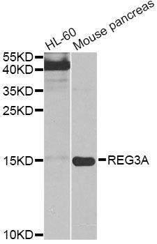 REG3A Antibody - Western blot analysis of extracts of various cell lines, using REG3A antibody at 1:1000 dilution. The secondary antibody used was an HRP Goat Anti-Rabbit IgG (H+L) at 1:10000 dilution. Lysates were loaded 25ug per lane and 3% nonfat dry milk in TBST was used for blocking. An ECL Kit was used for detection and the exposure time was 30s.