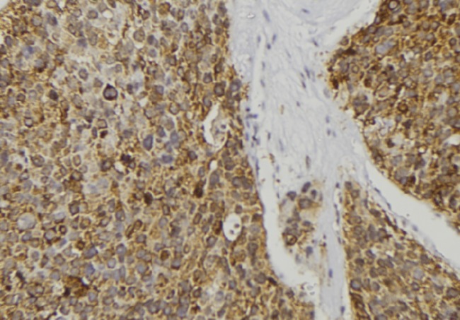 REG3A Antibody - 1:100 staining human pancreas tissue by IHC-P. The sample was formaldehyde fixed and a heat mediated antigen retrieval step in citrate buffer was performed. The sample was then blocked and incubated with the antibody for 1.5 hours at 22°C. An HRP conjugated goat anti-rabbit antibody was used as the secondary.
